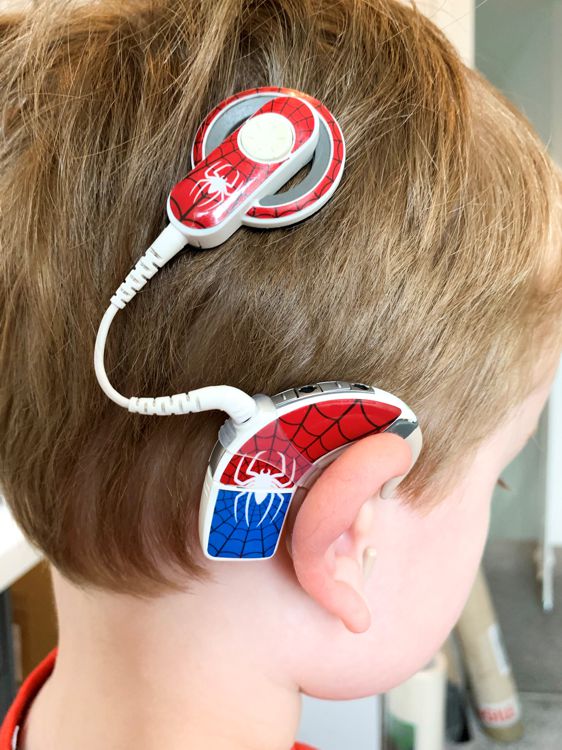 hearing aid decorated with printed graphics on a child
